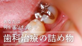 歯科治療の詰め物・被せ物。あなたは何を選びますか？